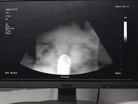 Emergency Dick - Unbroken  Bobtail   Benjamin Blue, Clark Delgaty, Tony D'Angelo, Dane Jaxson    stream full at  www.sexmen.com star chinese daddy porn gay