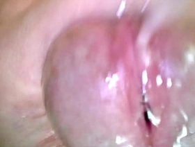 Korslaveman - Sounding with an endoscopic camera korean gay porn star